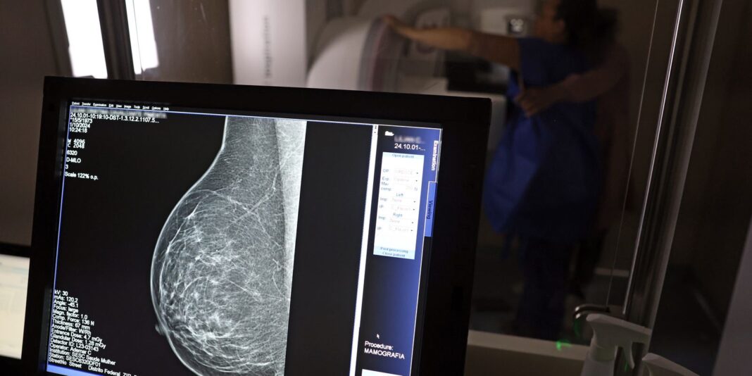 Planos de saúde agora cobrirão mamografia digital para todas as idades com indicação médica