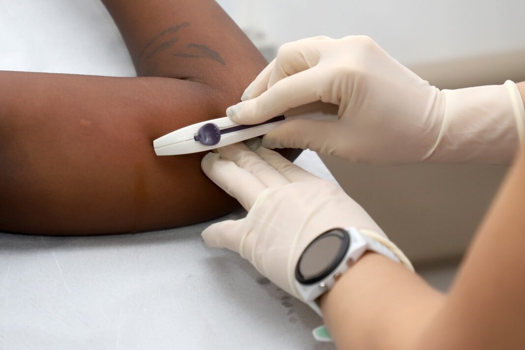 Implantes anticoncepcionais registram alta de 553% em Campinas com ampliação do acesso no SUS